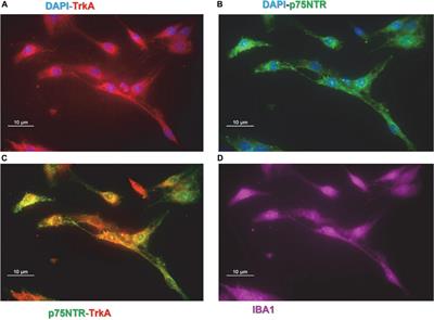 The effects of painless nerve growth factor on human microglia polarization